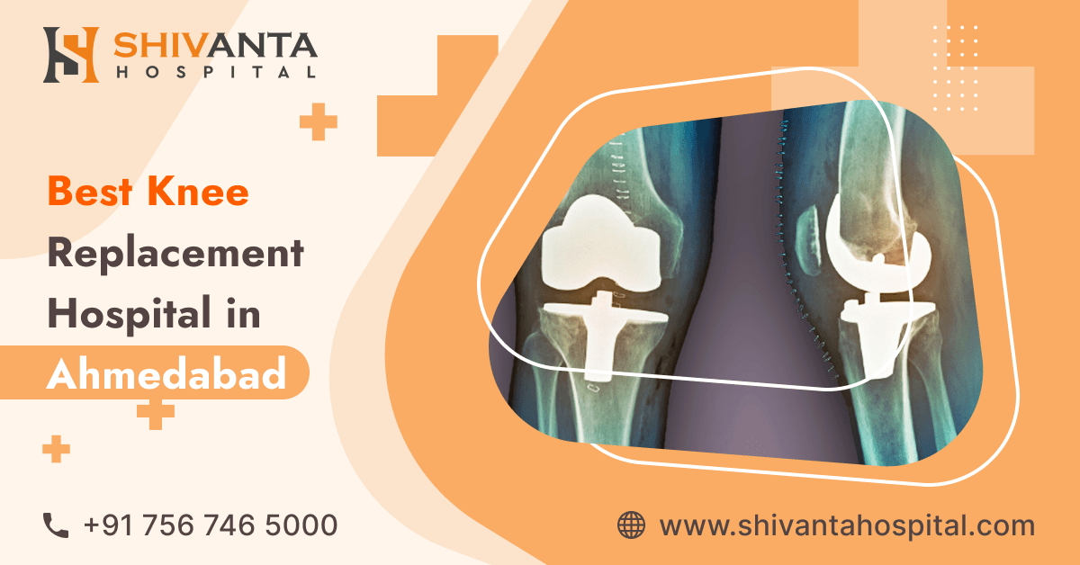 Best Knee Replacement Surgeon in Ahmedabad