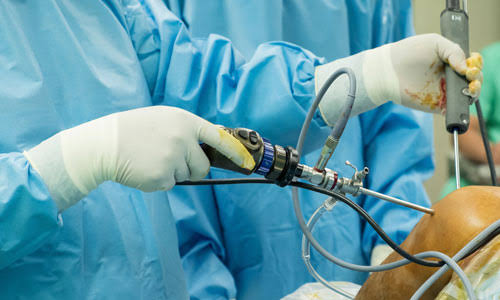 Laparoscopic Treatment