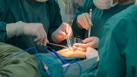 Genral surgery